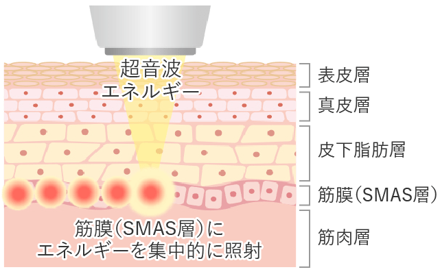 施術の特徴